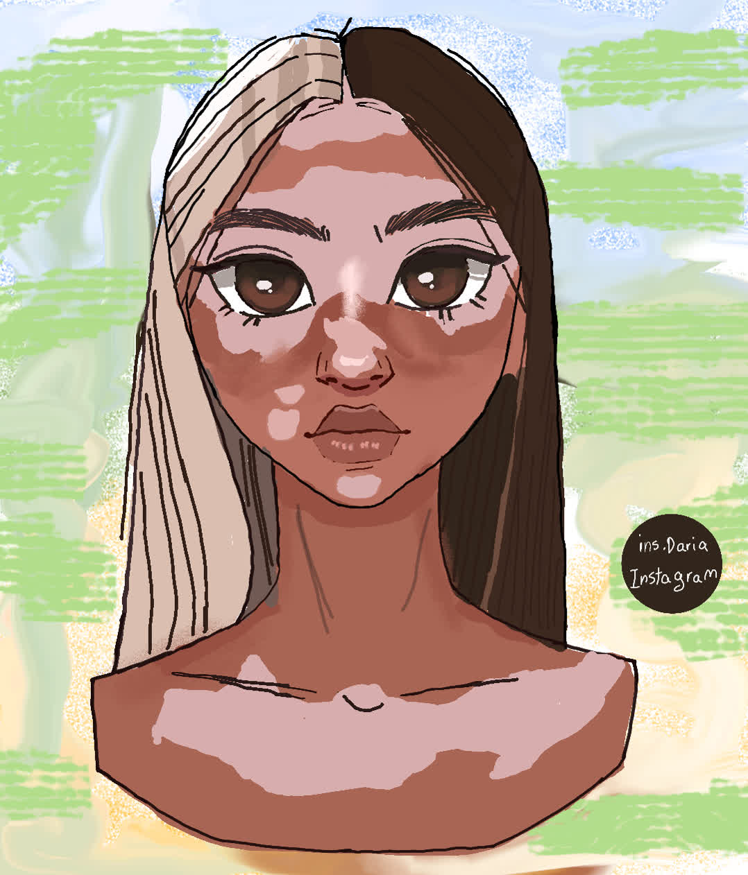 Woman with vitiligo patches, hair split between platinum blonde and dark brown, looking forward against a green and blue background.